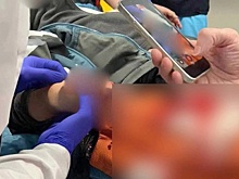 "Держится мужественно": Появились новые данные о пострадавшем от взрыва мальчике