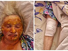 Опубликовали фото чудом выжившей при взрыве газа жительницы Новосибирской области