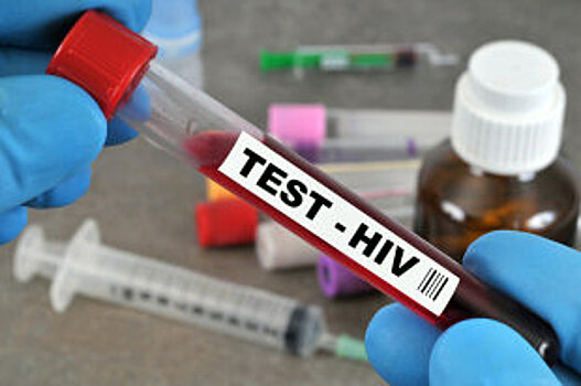 В Госдуме предложили обязать аптеки продавать тесты на ВИЧ
