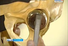 Красноярские врачи установили пациенту с донорским сердцем титановый сустав