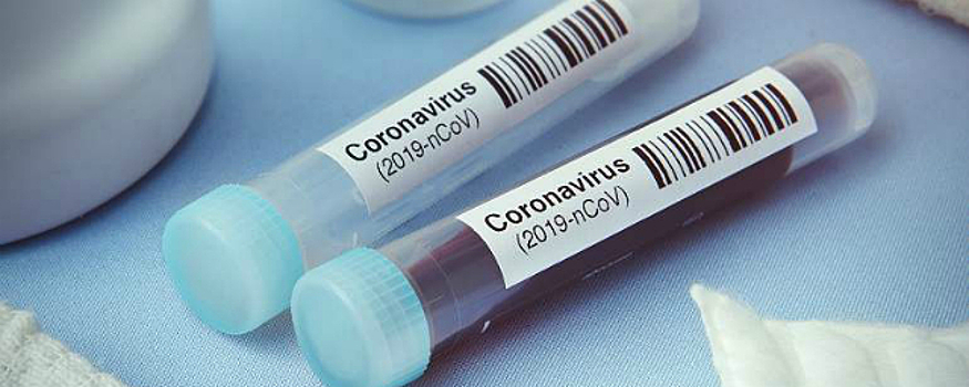 Во Владимирской области обнаружены еще 85 заразившихся COVID-19