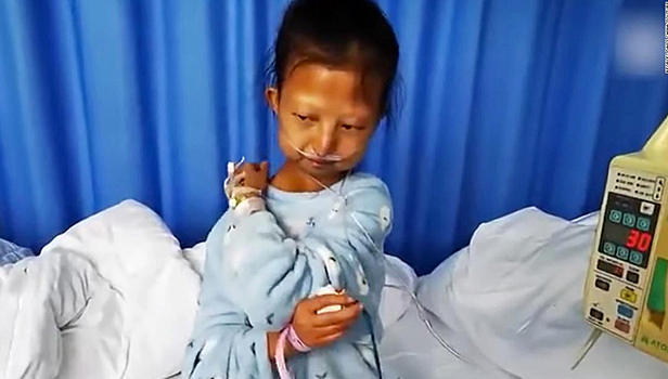 Китаянка питалась одним рисом и умерла