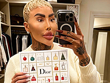 «Король губ» умер в Британии после процедуры у косметолога