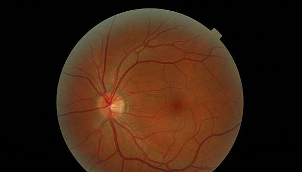 В России вырастили из перепрограммированных клеток сетчатку глаза