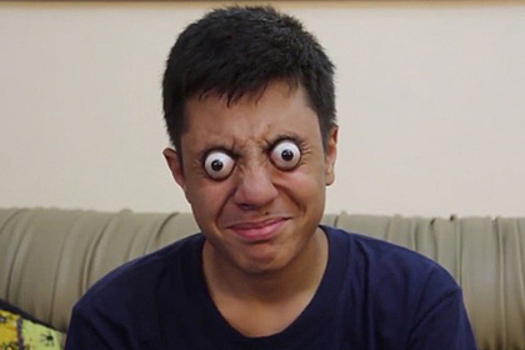 В Пакистане обнаружили самого пучеглазого мальчика