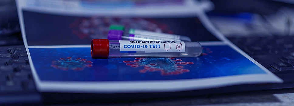 Ракова: Очередь на тесты на антитела к COVID-19 в поликлиниках Москвы расписана на две недели