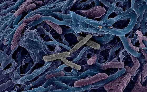 Бактерии могут жертвовать собой ради сородичей