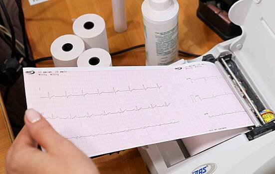 Разработана новая программа для анализа электрокардиограммы