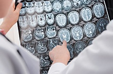 Невролог развеяла популярные заблуждения о работе мозга