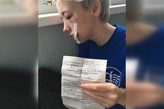 В Петербурге задержанных за избиение девушки подростков отпустили под обязательство о явке