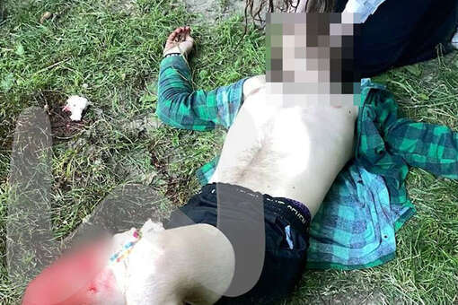 В Нижнем Новгороде пьяный прохожий ударил ножом юношу, заступившегося за девочку
