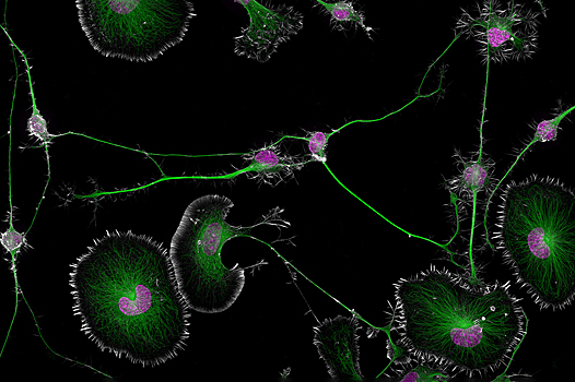 Электрические дуги и глаза паука: потрясающие снимки с конкурса Nikon Small World