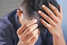 Пульмонолог перечислил основные причины выпадения волос