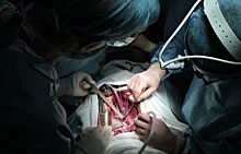 В Югре кардиохирурги спасли пациента с острым расслоением аорты