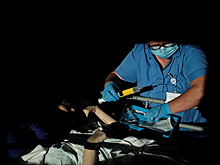 Врач назвал способ самостоятельно вычислить рак кишечника до симптомов