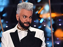 Киркоров сделал пластическую операцию