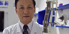 Хирурги в КНР впервые имплантировали сустав с использованием 3D-печати