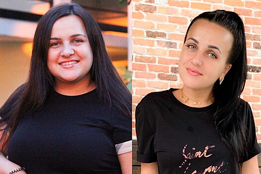 Как меняются лица сильно похудевших девушек? Гагарина, Адель. Фото до и после