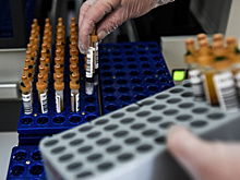 Более 500 человек пролечились в онкоцентрах Подмосковья с начала года