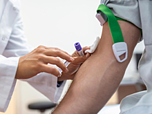 Врач рассказал, какие показатели должны быть у здорового человека