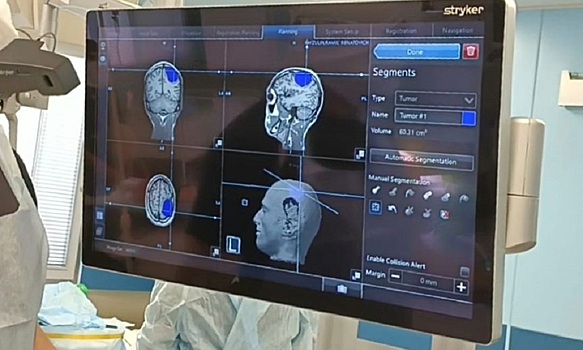 Падение с самоката спасло 20-летнему волгоградцу жизнь