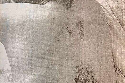 В Череповце мужчина получил на релакс-массаже ожоги и отсудил компенсацию