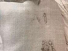 В Череповце мужчина получил на релакс-массаже ожоги и отсудил компенсацию