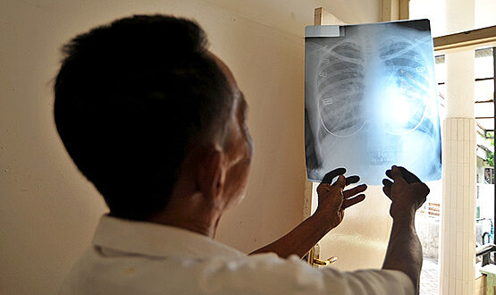 Тучные люди рискуют заболеть раком из-за рентгена