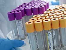 В Рязанской области за сутки выявлено 73 случая заражения COVID-19