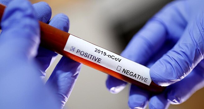 В РФ придумали групповые тесты на коронавирус