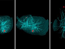 Учёные нашли новый способ диагностики опухолей