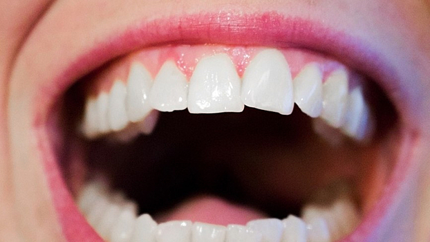 Стоматолог рассказал о вреде алкоголя для здоровья зубов
