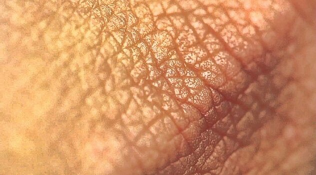 Исследователи благополучно преобразовали клетки кожи в моторные нейроны