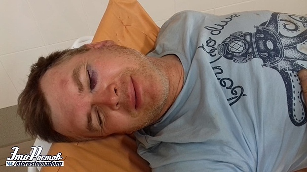 Разрыв связок и амнезия: ростовский велосипедист получил травмы из-за ямы на дороге