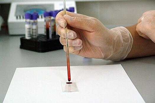 Российский врач назвала признаки рака крови на ранней стадии