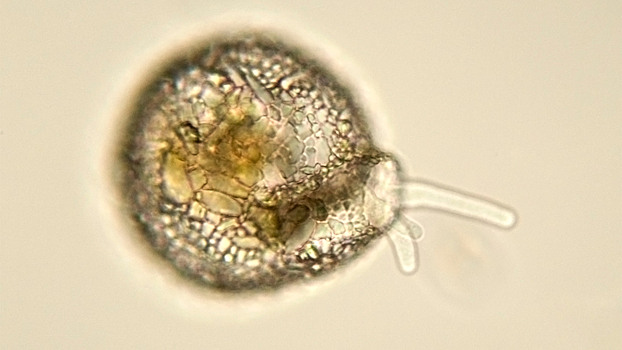 Пожирающая мозг амёба убила 19 человек