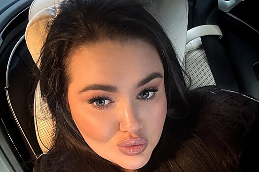 «Мое тело изменилось»: дочь Пригожина объяснила, зачем ей вторая пластическая операция