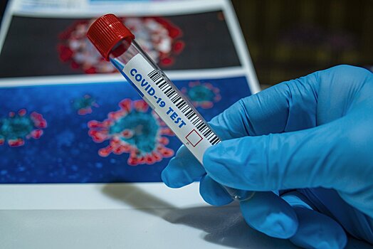В Москве выявили 15 442 случая заражения коронавирусом за сутки