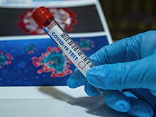 В Москве выявили 15 442 случая заражения коронавирусом за сутки