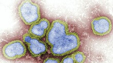 В Британии впервые зафиксирован случай заражения свиным гриппом H1N2