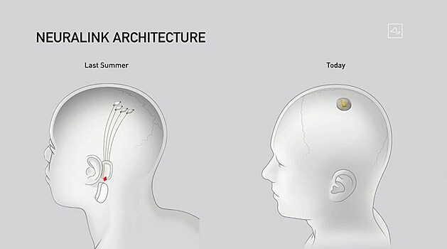 Илон Маск показал чип, вживлённый в мозг. Он поможет лечить болезни и управлять играми