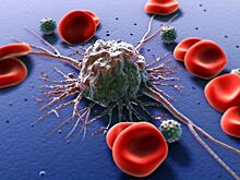 Это не вызывает рак: главные мифы об онкологии