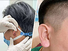 Вьетнамцы массово стали делать "Уши Будды"