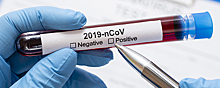 Число жертв коронавируса в Великобритании в этом году может превысить 100 000 человек