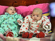 В Китае женщина родила двойню от разных мужчин