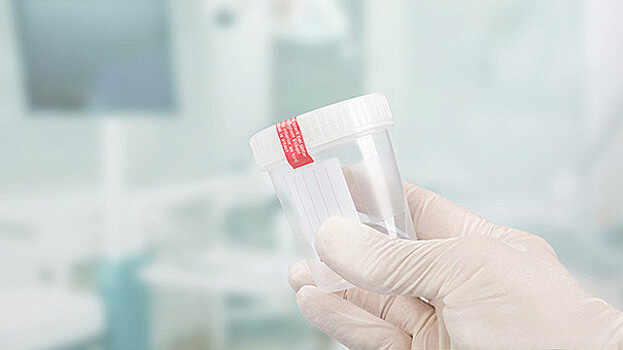 Как это устроено: банки спермы, донорство и применение биоматериала