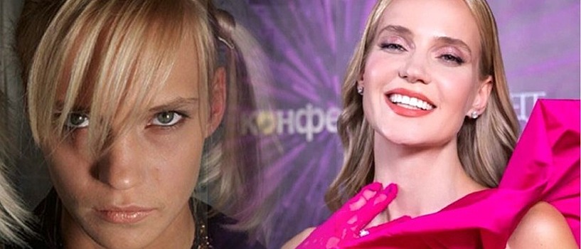 Круглолицая милая девушка с блеском в глазах: Как Наталья Ионова попала в шоу-бизнес и какой была до пластики