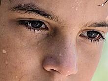 Обильный пот не всегда безобиден