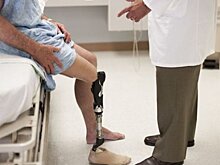 Значительной части ампутаций при сахарном диабете можно избежать