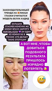 Дана Борисова показала честное фото своего лица через неделю после нашумевшей операции «лисьи глазки»